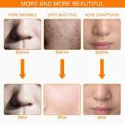 Led Photon Rejuvenation Anti Wrinkle Face Mask - Shrewsburry