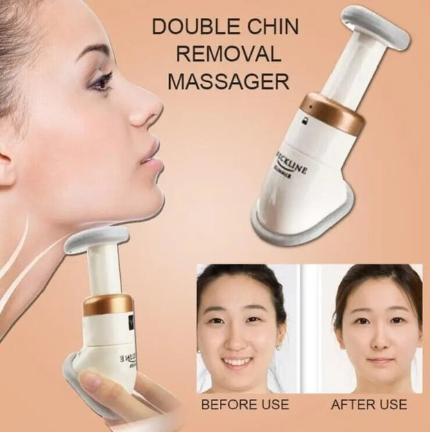 Reduce Double Chin Face Lift Tools Device - Shrewsburry