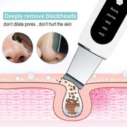 Ultrasonic Skin Scrubber Face Cleanser - Shrewsburry