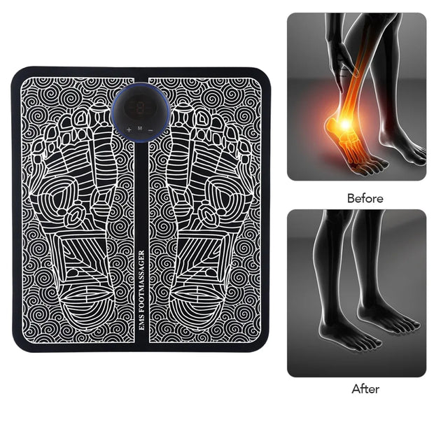 EMS Electric Foot Massager - Shrewsburry