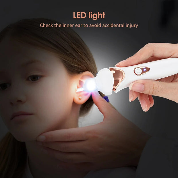 Electric Luminous Electric Ear Suction Device - Shrewsburry